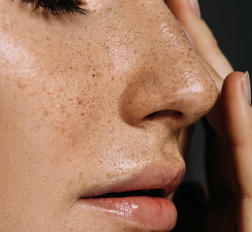 Mesopeptide Skin Boosters for revitalizing dull, damaged skin and improving skin tone – Kalon Skin Lab | Medical Spa | IV Drip Lounge in Whitby, serving Oshawa, Ajax, Pickering, Bowmanville, Port Perry, Uxbridge, Scarborough