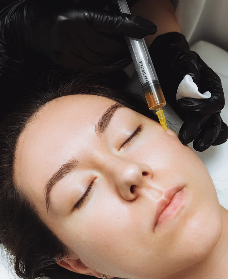 PRP Vampire Facial with microneedling for glowing, youthful skin – Kalon Skin Lab | Medical Spa | IV Drip Lounge in Whitby, serving Oshawa, Ajax, Pickering, Bowmanville, Port Perry, Uxbridge, Scarborough